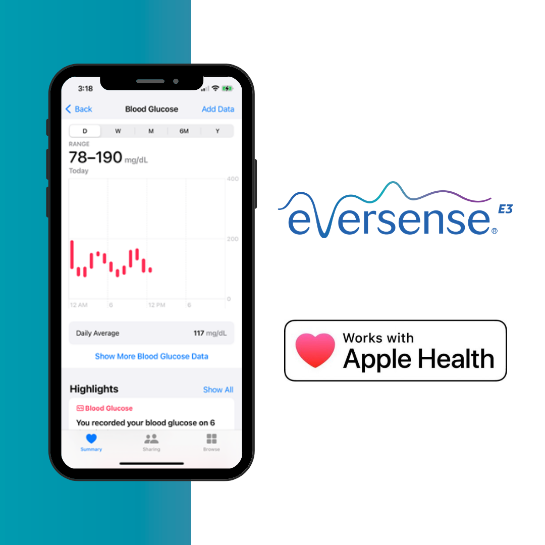 Smartphone displays Eversense app tracking blood glucose levels.
